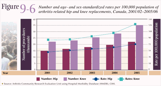 Figure 9-6: Number and age- and sex-standardized rates per 100,000 population of arthritis-related hip and knee replacements, Canada, 2001/02–2005/06