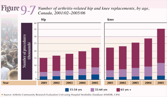 Figure 9-7: Number of arthritis-related hip and knee replacements, by age, Canada, 2001/02–2005/06