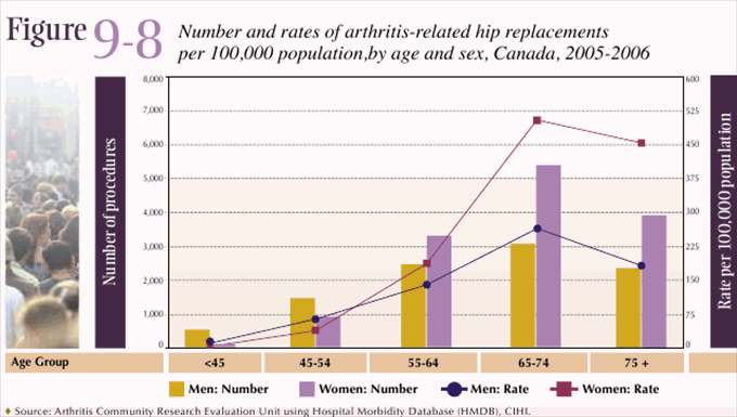 Figure 9-8: Number and rates of arthritis-related hip replacements per 100,000 population,by age and sex, Canada, 2005-2006