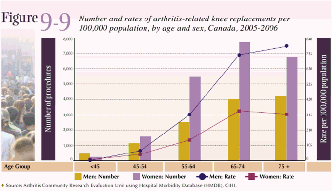 Figure 9-9:Number and rates of arthritis-related knee replacements per 100,000 population, by age and sex, Canada, 2005-2006