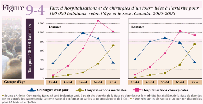 Figure 9-4: Taux d'hospitalisations et de chirurgies d'un jour* li&eacute;es &agrave; l'arthrite pour 100 000 habitants, selon l'&acirc;ge et le sexe, Canada, 2005-2006