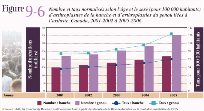 Figure 9-6: Nombre et taux normalis&eacute;s selon l'&acirc;ge et le sexe (pour 100 000 habitants) d'arthroplasties de la hanche et d'arthroplasties du genou li&eacute;es &agrave; l'arthrite, Canada, 2001-2002 &agrave; 2005-2006