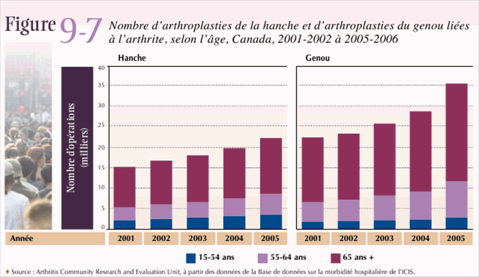 Figure 9-7:  Nombre d'arthroplasties de la hanche et d'arthroplasties du genou li&eacute;es &agrave; l'arthrite, selon l'&acirc;ge, Canada, 2001-2002 &agrave; 2005-2006