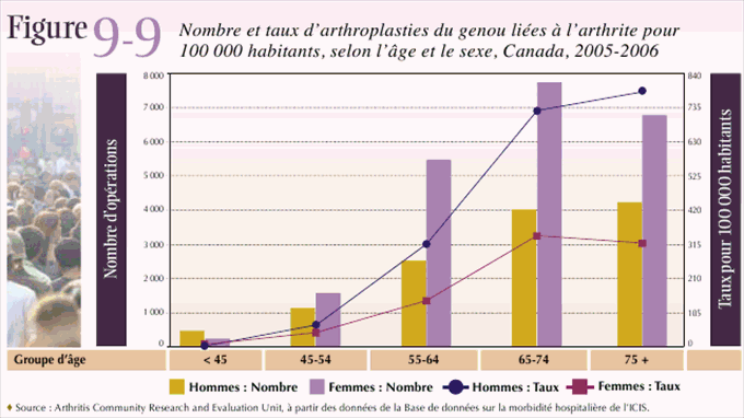 Figure 9-9: Nombre et taux d'arthroplasties du genou li&eacute;es &agrave; l'arthrite pour 100 000 habitants, selon l'&acirc;ge et le sexe, Canada, 2005-2006