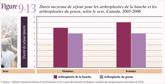 Figure 9-13: Dur&eacute;e moyenne de s&eacute;jour pour les arthroplasties de la hanche et les arthroplasties du genou, selon le sexe, Canada, 2005-2006