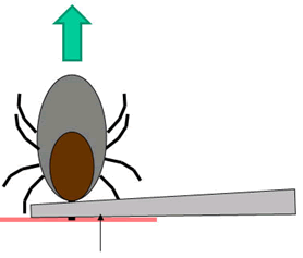 Tick removal  -  Front view
